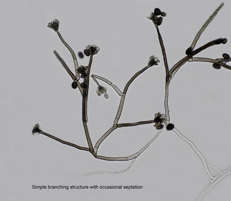 Stachybotrys chartarum Fungus Species